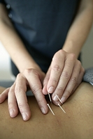 Welcome to Acupuncture and Weight Loss